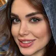 لنز رنگی طوسی رز چرسی گری