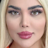 از رو به رو با فاصله نزدیک