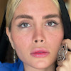 مقایسه چشم طبیعی با لنز