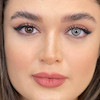 مقایسه چشم طبیعی بدون لنز و با لنز