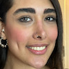 مقایسه چشم طبیعی با لنز