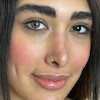 مقایسه چشم طبیعی بدون لنز و با لنز