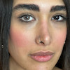 روی چشم تیره