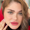 طوسی طبیعی و بدون دور با پترن رگه ای