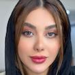 لنز رنگی یونیک ژربرا