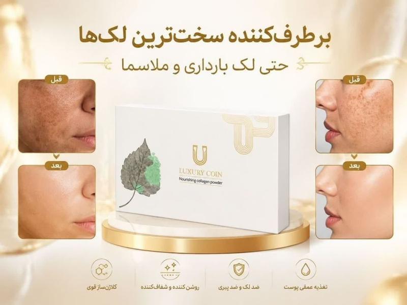 پودر کلاژن لاکچری کویین 