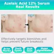 سرم آزلائیک اسید 16 درصد مدی کیوب Azelaic acid 16 BB calming serum 30ml (Medicube)