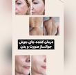 سرم روشن کننده و لایه بردار تخصصی بدن نسخه اورجینال AHA