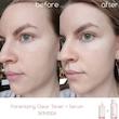 آمپول کنترل و کوچک کننده منافذ اسکین ماداگاسکار SKIN 1004 Poremizing Fresh Ampoule