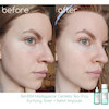 تونر ضدجوش تی تریکا اسکین 1004 SKIN1004 Centella Tea-Trica Purifying Toner