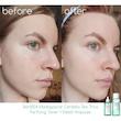 تونر ضدجوش تی تریکا اسکین 1004 SKIN1004 Centella Tea-Trica Purifying Toner