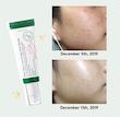 سرم ضدلک دارک اسپات اکسیس وای AXIS-Y Dark Spot Correcting Glow Serum