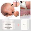 چسب بینی سرسیاه لانبنا-Lanbena nose plants pores strips