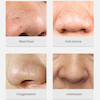 چسب بینی سرسیاه لانبنا-Lanbena nose plants pores strips