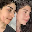 قطره کلروفیل مایع پیور اورا