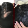 کپسول مو هیرتامین-Hairtamin advanced formula