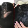 کپسول مو هیرتامین-Hairtamin advanced formula