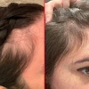 کپسول مو هیرتامین-Hairtamin advanced formula