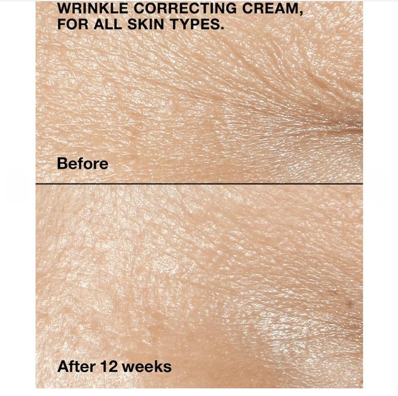 کرم ضد چروک کلینیک، کرم ضد پیری کلینیک، کرم اسمارت کلینیکال ریپیر، Clinique Smart Clinical Repair Cream، کرم جوانساز پوست، کرم ضد چروک صورت، کرم ضد چروک قوی، کرم لیفت صورت، کرم سفت کننده پوست، کرم ضد خطوط ریز، کرم ضد چروک پیشانی، کرم ضد چروک دور لب، کرم کاهش چین و چروک، کرم بازسازی کننده پوست، کرم ترمیم کننده پوست، کرم آبرسان ضد چروک، کرم جوان کننده پوست، کرم مراقبت پوست بالغ، کرم ضد پیری پوست، کرم صاف کننده پوست، کرم بهبود بافت پوست، کرم افزایش استحکام پوست، کرم افزایش خاصیت ارتجاعی پوست، کرم ضد افتادگی پوست، کرم صورت کلینیک، محصولات کلینیک، کرم صورت خارجی، کرم اصل کلینیک، کرم ضد چروک اورجینال، کرم مراقبت روزانه پوست، کرم پوست حساس، کرم ضد چروک پوست خشک، کرم ضد چروک پوست مختلط، کرم ضد چروک زنانه، کرم ضد پیری لوکس، کرم جوانسازی صورت، کرم ضد پیری صورت، کرم رفع خطوط ریز، کرم ضد چروک گردن، کرم آنتی ایجینگ، کرم ضد پیری حرفه‌ای، کرم ضد پیری خارجی، کرم ضد چروک پوست حساس، کرم بازسازی پوست صورت، کرم مراقبت ضد پیری، کرم ترمیم و جوانسازی پوست، کرم شاداب کننده پوست، کرم افزایش لطافت پوست، کرم ضد پیری کلینیکی، کرم ضد چروک روز و شب، کرم ضد چروک فاقد عطر، کرم ضد چروک فاقد پارابن، کرم ضد چروک غیر کومدوژنیک، anti aging cream, wrinkle correcting cream, clinique smart clinical repair, clinique wrinkle cream, anti wrinkle cream, firming face cream, skin repair cream, facial moisturizer, anti aging moisturizer, wrinkle repair cream, skin firming cream, collagen support cream, fine line treatment, mature skin cream, face lifting cream, skin renewal cream, skin smoothing cream, hydrating anti aging cream, anti wrinkle moisturizer, luxury skincare, facial repair cream, dermatologist tested skincare, sensitive skin anti aging cream, skin elasticity cream, wrinkle reduction cream, anti aging skincare, premium face cream, youth boosting cream, firming moisturizer, daily anti aging cream.