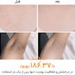اسپری پیل شات کوجیک اسید دکتر ملاکسین لایه بردار و روشن کننده بدن