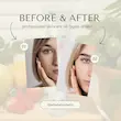 سرم ترمیم کننده پوست آرتیستا | Artista Skin balanced