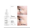 سرم ضد چروک و پرکننده خطوط آرژیرلین 10% اوردینری ORDINARY