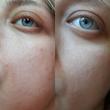تونر سنتلا ماداگاسکار اسکین 1004 SKIN1004 Madagascar Centella Toning Toner