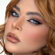 لنز لوتوس یونیک