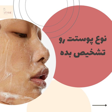 چطور نوع پوست خود را تشخیص دهیم؟