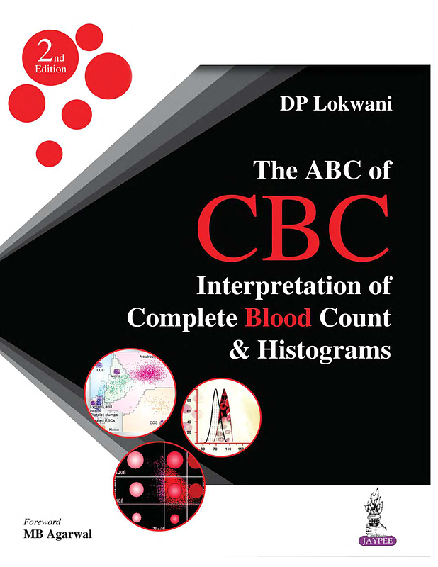  The ABC of CBC: Interpretation of Complete Blood Count and Histograms