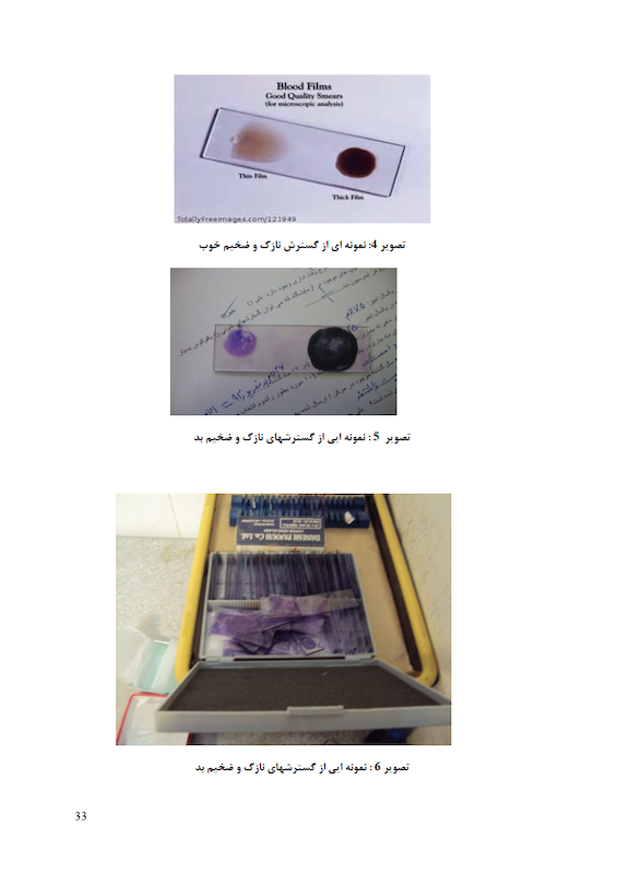 آزمایشگاه مالاریا