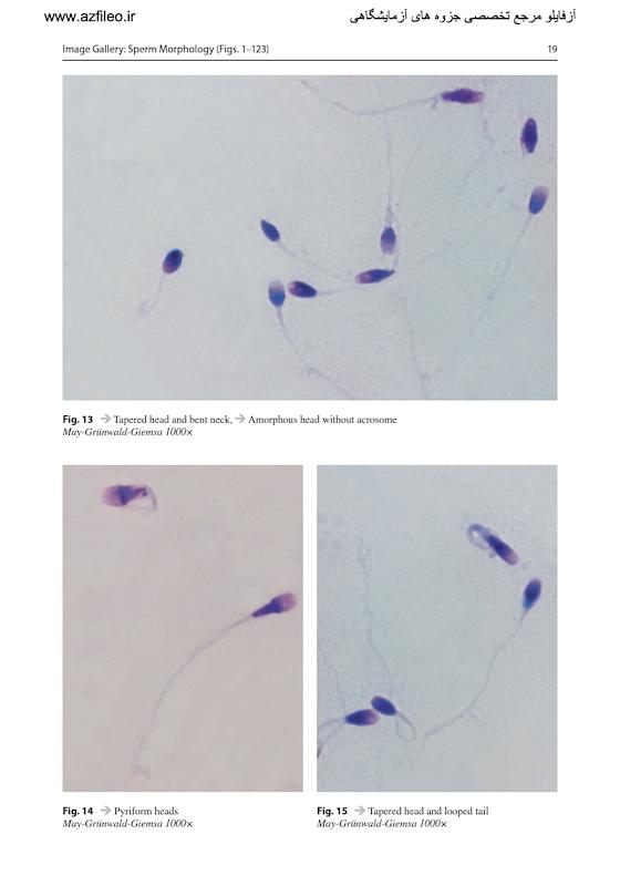 Atlas of Human Semen Examination