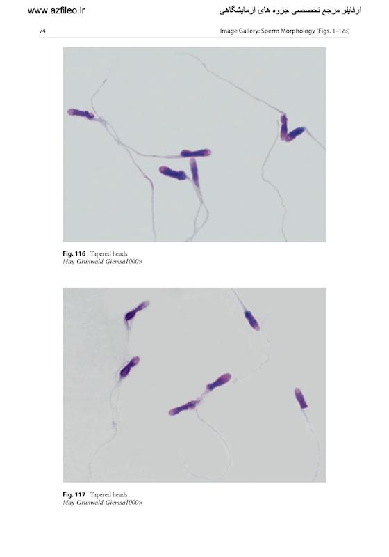 Atlas of Human Semen Examination