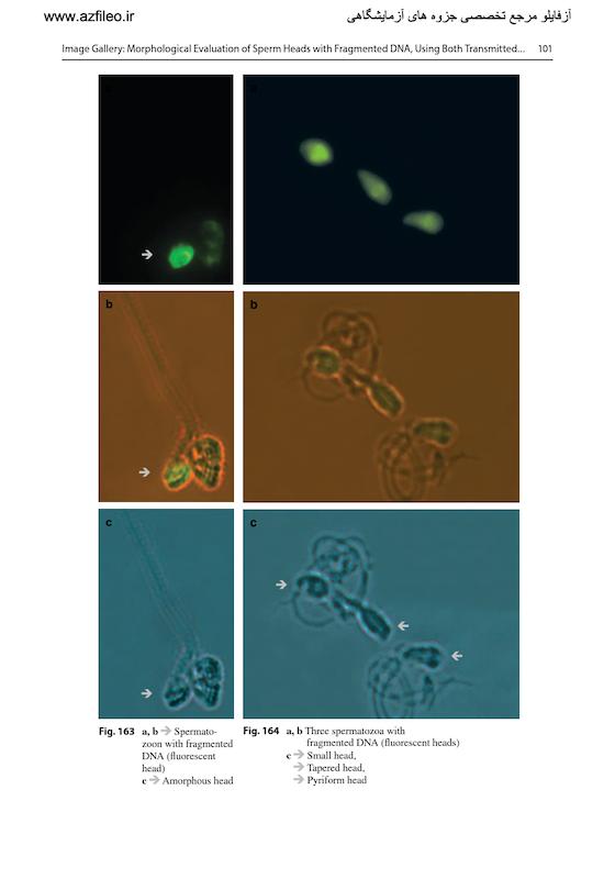 Atlas of Human Semen Examination