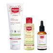 کرم ضد ترک 150 میل مدل Maternite موستلا Mustela