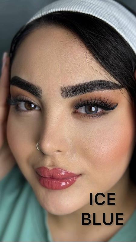 لنز پنج ساله برند کلینیک 