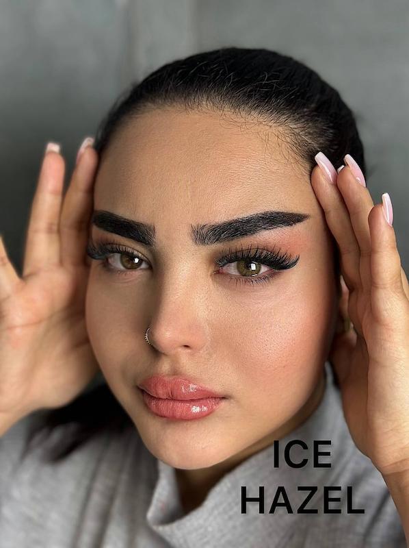 لنز پنج ساله برند کلینیک 