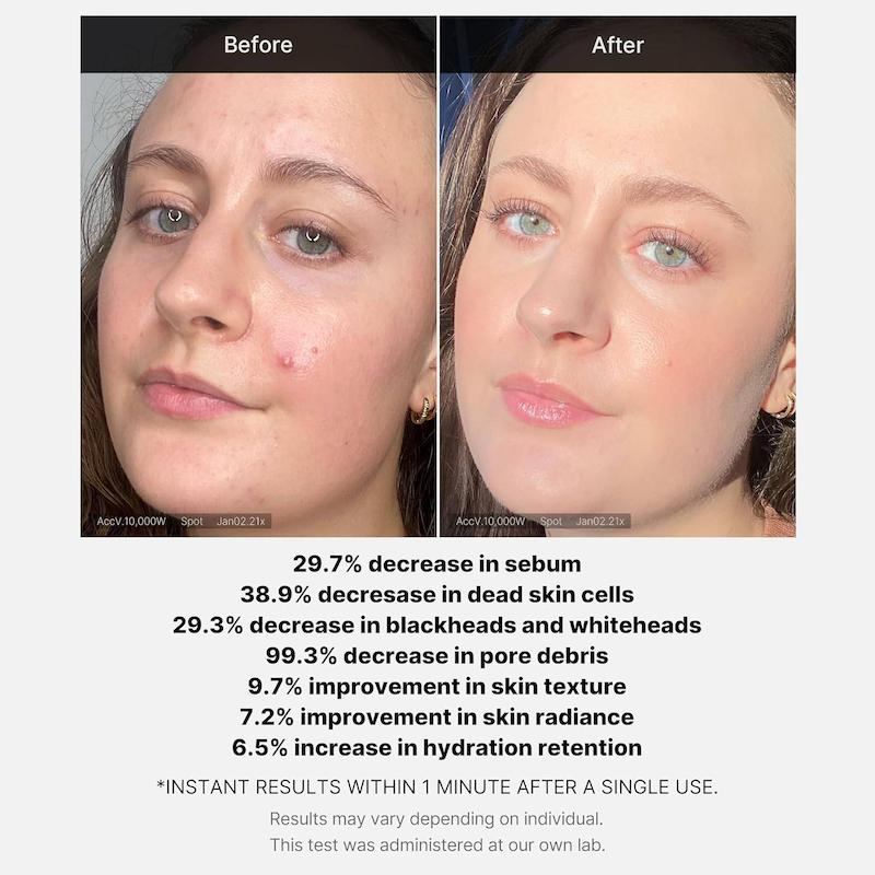 سرم پاک‌کننده و ضدجوش مدیکیوب | Medicube Red Succinic Acid Cleansing Booster Serum