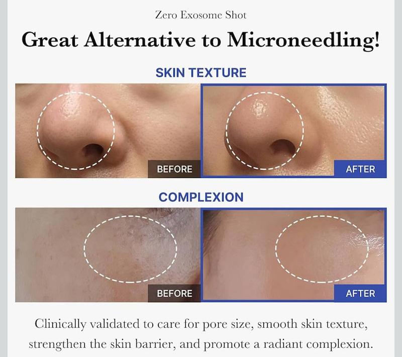 سرم بازسازی و لایه‌بردار کره‌ای مدیکیوب | Medicube One Day Easy Peeling Serum