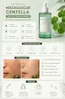 سرم آرام‌بخش و ترمیم کننده پوست سنتلا ماداگاسکار |  Centella SKIN1004 