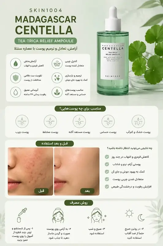 سرم آرام‌بخش و ترمیم کننده پوست سنتلا ماداگاسکار |  Centella SKIN1004 