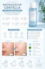 تونر روشن‌کننده سنتلا ماداگاسکار SKIN1004 مدل Hyalu-Cica