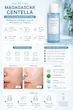 تونر روشن‌کننده سنتلا ماداگاسکار SKIN1004 مدل Hyalu-Cica