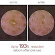 آمپول پیل شات برنج لایه بردار و روشن کننده دکتر ملاکسین اورجینال  Dr.Melaxin Peel Shot Glow White Rice Peeling Ampoule