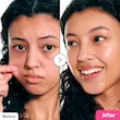 سرم جوانساز و ضدچروک NAD+ peptide boosting اکوال بری 