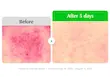سرم ترمیم کننده و ضدقرمزی Aloe PDRN calming اکوال بری 