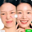 سرم ترمیم کننده و ضدقرمزی Aloe PDRN calming اکوال بری 