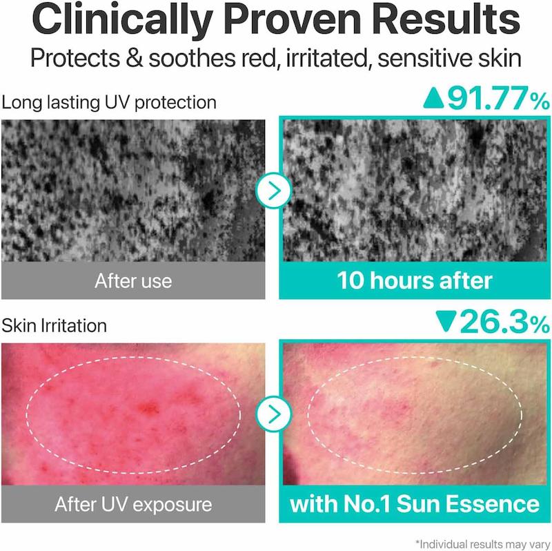 ضد آفتاب تیوپی نامبوزین شماره 1 SPF50+ | سبک و مناسب پوست چرب
