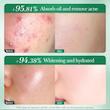 تونر پاک‌کننده صورت سادور مدل ANTI-ACNE مناسب برای پوست آکنه‌ای حجم 130 میلی‌لیتر