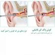 مجموعه نظافت گوش مدل Ear Care-03 بسته 6 عددی